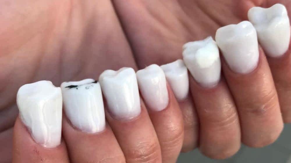 Diseño De Uñas Mas Ridiculas