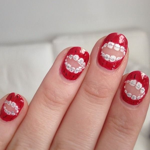 diseno-de-unas-y-de-brackets-3